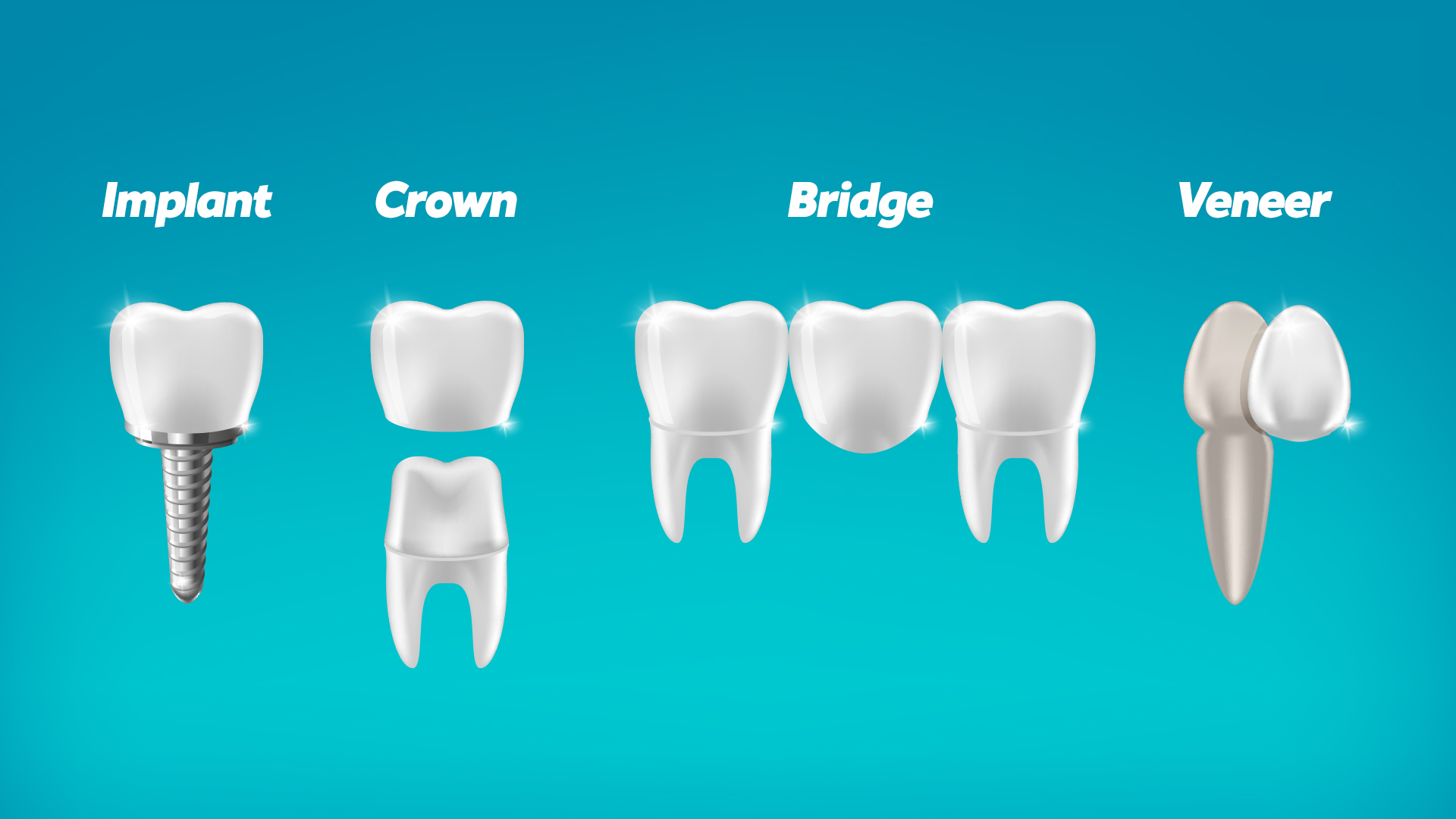 Dental Prosthesis